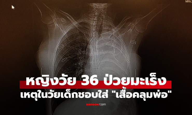 ช็อกสุดขีด! สาว 36 เจอมะเร็งร้ายจาก เสื้อคลุมพ่อ วัยเด็ก หมอบอกเหลือชีวิตแค่ 15 เดือน?! - betfahvip