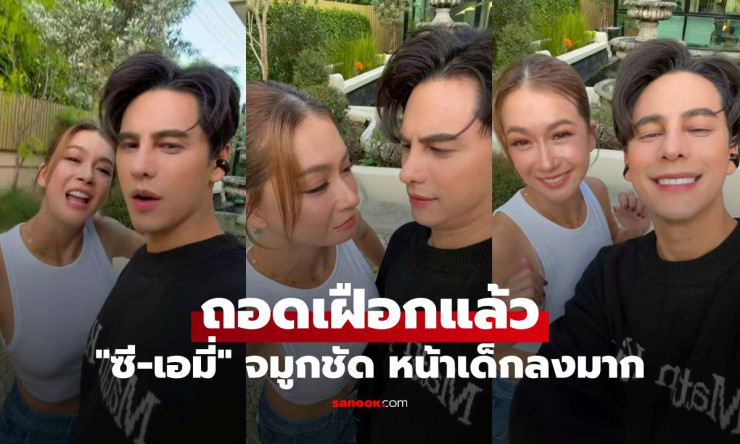 ซี-เอมี่ ถอดเฝือกแล้ว ศัลยกรรมแพ็กคู่ จมูกชัด หน้าเด็กลงมาก - betfahvip