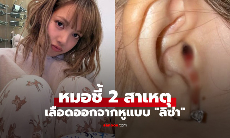 แพทย์เตือน 2 สาเหตุหลักเลือดไหลออกจากหูแบบลิซ่า พร้อมวิธีรับมือเมื่อเกิดอาการ - betfahvip
