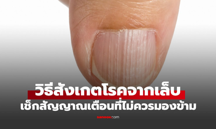 เล็บผิดรูป! สัญญาณเตือนร้ายจากร่างกายที่คุณมองข้ามไม่ได้ ตรวจด่วนก่อนสายเกิน! - betfahvip