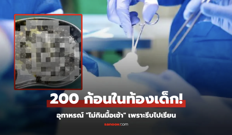 ลูกสาว 10 ขวบ ไม่กินมื้อเช้า พ่อแม่ช็อก ผ่าสิ่งนี้จากท้อง 200 ก้อน แพทย์ยังตกใจทั้งทีม! - betfahvip