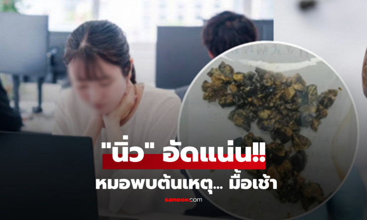 ช็อกหนัก! สาวกินมื้อเช้าแล้วปวดท้องยืนไม่อยู่ ผ่าเจอนิ่วถุงน้ำดีเต็มถังนับไม่ไหว แพทย์อึ้ง!! - betfahvip
